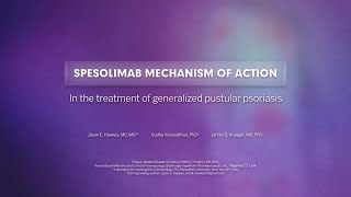 Spesolimab mechanism of action in the treatment of generalized pustular psoriasis