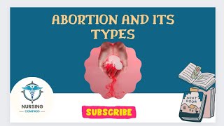 Abortion and it's types| B.Sc Nursing| #education #nursing #trending #nursingeducation #aiims#norcet