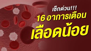 16 สัญญาณเตือนอาการเลือดน้อย โลหิตจาง ที่ไม่ควรชะล่าใจ