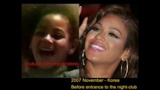 Beyonce plastic surgery - The Truth