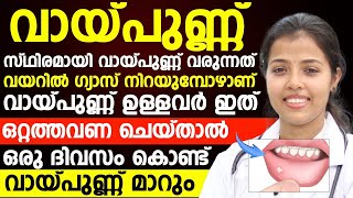 സ്ഥിരമായി വായ്പുണ്ണ് വരുത്തുന്ന ഈ കാരണം എങ്ങനെ പരിഹരിക്കാം|