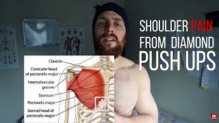 Shoulder Pain from Diamond Push-ups ( Are Push-up Variations safe?)