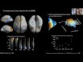 The Unique Cytoarchitecture and Wiring of The Default Mode Network