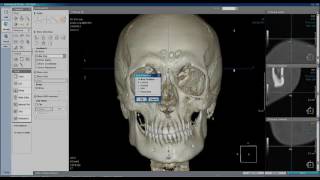 3D Ceph x ray