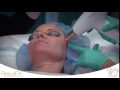 resurfx laser the vein u0026 cosmetic center of tampa bay