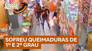 Mulher sofre queimaduras após celular explodir em bolso de calça | Cidade Alerta DF