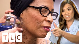 Dr Lee Freezes A Record Number Of 307 Keratoses In One Patient | Dr. Pimple Popper