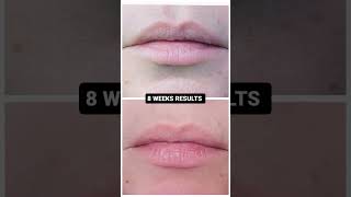 👄 THIS WILL GIVE YOU PLUMPER YOUNGER LIPS IN ONLY 8 WEEKS 💋 #beautytools #ledlighttherapy #itworks