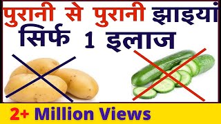 पुरानी से पुरानी झाइयां न ही खीरा न ही आलू सिर्फ 1 इलाज |Get Rid Of Pigmentation, Dark Spots On Face