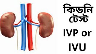 IVP or IVU kidney test.  কিডনি টেস্ট IVP or  IVU