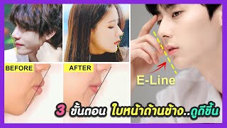 3 Steps!! How to make your side face profile look better without surgery.