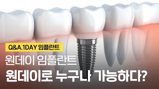 원데이 임플란트 누구나 다 가능하다❓ 당일임플란트 부작용 단점 후기