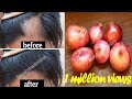 Grow your Hair Faster with Onion Juice | STOP Hair Fall with Home Remedy | 100% Working