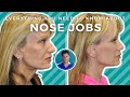 NOSE JOB SURGERY EXPLAINED: WHAT YOU NEED TO KNOW ABOUT RHINOPLASTY AND REVISION RHINOPLASTY