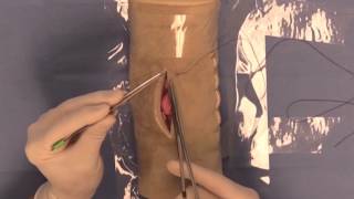 Simple Interrupted Suture Pattern