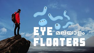 ആകാശത്തെ പ്രാണികൾ ! | EYE FLOATERS EXPLAINED IN MALAYALAM | BLUE FIELD ENTOPTIC PHENOMENON | KUTHUKI