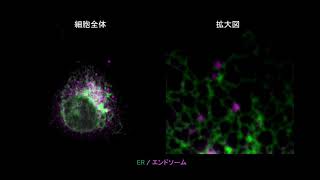 細胞動態実験室の顕微鏡〜（３）広視野イメージングが可能な共焦点顕微鏡