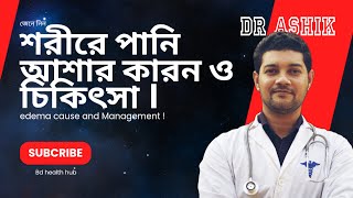 শরীরে পানি জমার কারণ, লক্ষণ ও প্রতিকার ! Oedema management |