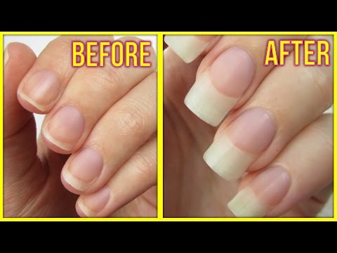 5 Ways to Grow Your Nails FAST! 5 Ways to Grow Your Nails FAST!