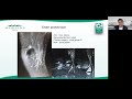 an overview of the anterolateral compartment of the knee ocad multidisciplinary lecture series