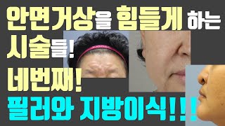 (※수술장면포함※) 안면거상을 힘들게 하는 시술들! 그 네번째 시간~ 필러와 지방이식!!!