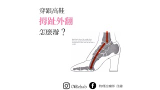 穿高跟鞋，讓你拇指外翻嗎？  ｜物理治療師 佳緯