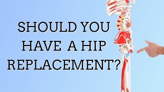 Should You Have Hip Replacement Surgery? Maybe Not