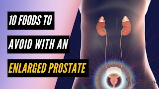 10 Foods To AVOID with an ENLARGED PROSTATE