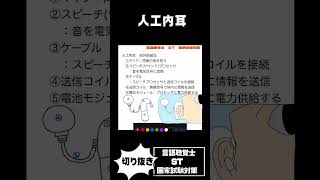 人工内耳　補聴器との併用OK？小児の適応は？一側性難聴も保険適応となる？テレメトリーやサウンドプロセッサとは