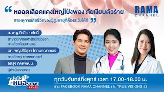 ลัดคิวหมอ - หลอดเลือดแดงใหญ่โป่งพอง ภัยเงียบตัวร้าย 28/02/66 l RAMA CHANNEL