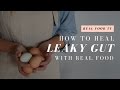 Is Leaky Gut the Cause of your Allergies, Asthma, Digestive Issues, Anxiety, etc?