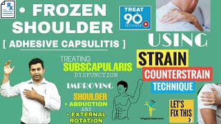 STRAIN COUNTERSTRAIN TREATMENT FOR FROZEN SHOULDER : GAINING EXTERNAL ROTATION RANGE.💪