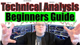 Technical Analysis For Beginners (ULTIMATE GUIDE) 📈 Candles & Patterns for Stock Market Investing