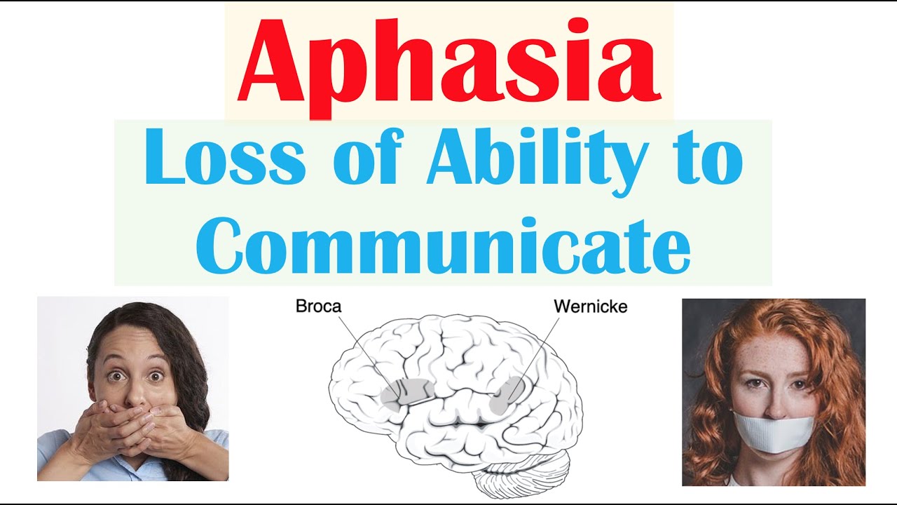 Aphasia Causes Aphasia Causes
