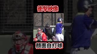 【衝撃映像】軟式野球の顔面自打球。#shorts