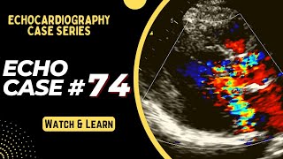 ECHO CASE 74 | Echocardiography spot diagnosis Series | Echocardiogram Reporting | Echo Board