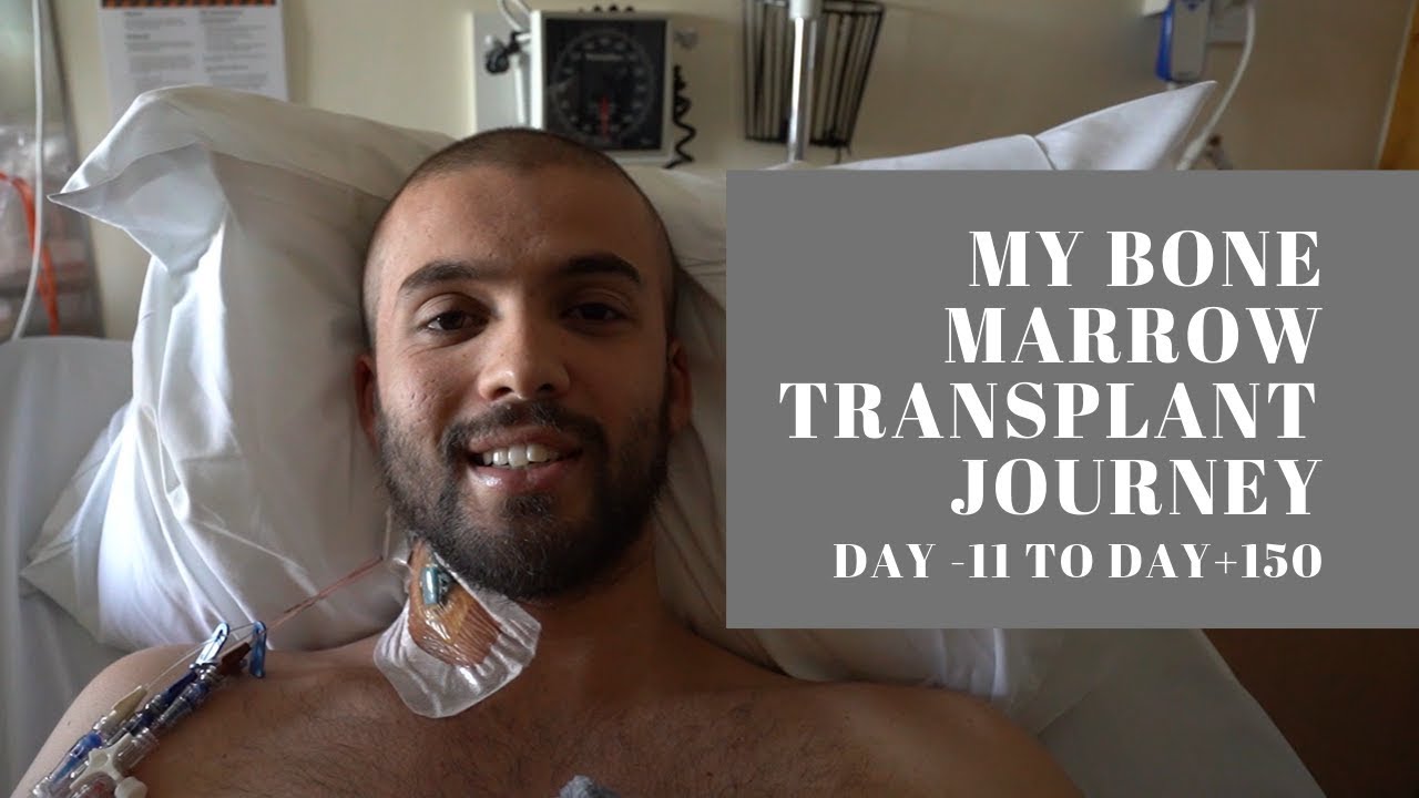 My Bone Marrow Transplant Journey | Day -11 To Day +150 | Vlog ...