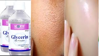 Use glycerin This way you skin will look so young, thight and Spotless glycerin for skin