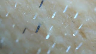 Follicle From Hair
