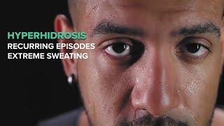 How to Stop Excessive Sweating