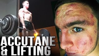 ACCUTANE & WORKING OUT | Side Effects, Joint Pains, Strength Loss?