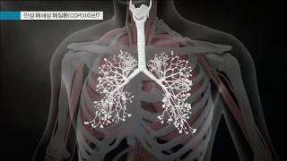 만성 폐쇄성 폐질환(COPD)이란?