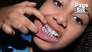 North West, 10, shows off diamond grills as dad Kanye debuts $850K titanium dent