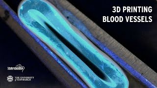 3D Printing Blood Vessels