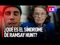 Síndrome de RAMSAY HUNT: ¿cómo es la condición médica que padecen JUSTIN BIEBER y Dianne Feistein?