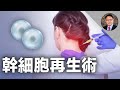 癱瘓也能治好？！幹細胞+泌外體治療讓多種疾病不再難治！