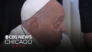 Pope Francis suffers health setback