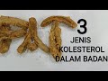 3 jenis KOLESTEROL/LEMAK dalam badan