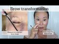 Brow transformation