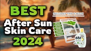 Top Best After Sun Skin Care in 2024 \u0026 Buying Guide - Must Watch Before Buying!